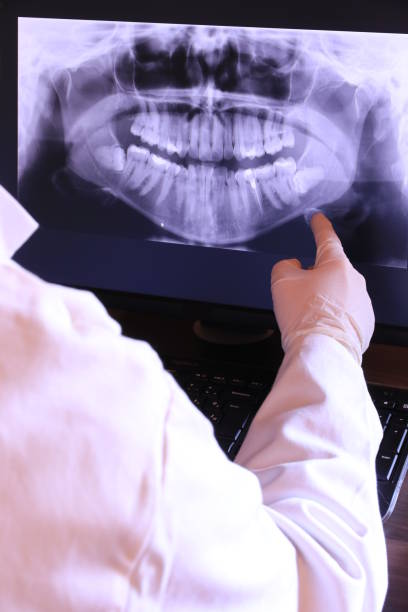Best Emergency Dentist for Knocked-Out Tooth in La Vergne, TN