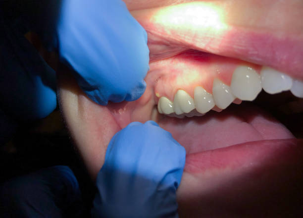 Best Broken or Cracked Tooth Emergency Dentist in La Vergne, TN